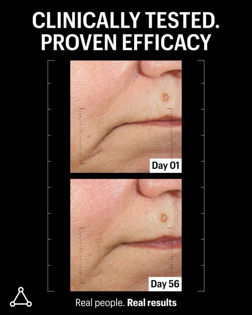 Allies of Skin Peptides & Antioxidants Advanced Firming Daily Treatment with 13 Brighteners, 9 Antioxidants, 7 Firming Peptides, 5% Teprenone & Ferulic Complex and 3% Biotech Algae Complex 20ml/0.67oz