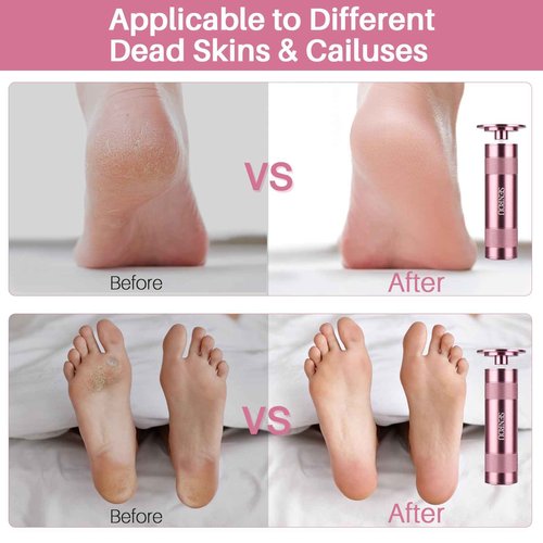 Electric Foot File Callus Remover, 2-in-1 Nail Grinder, Adjustable Speed, 60 Sandpaper Discs, Rose Gold