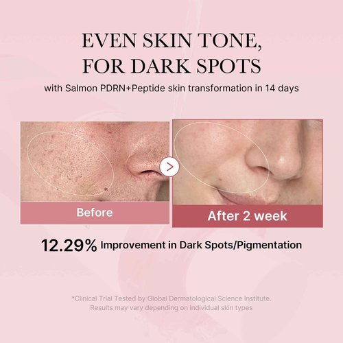 medicube Salmon DNA PDRN Pink Trio Set: Salmon DNA PDRN Pink Peptide Serum and Salmon DNA PDRN Pink CICA Soothing Toner and Salmon DNA PDRN pink collagen jelly gel mask (4ea)