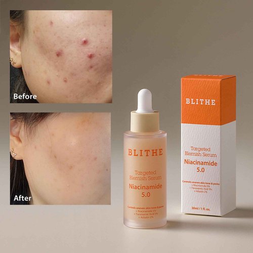 BLITHE Dark Spot Corrector & Tightening Serum Bundle Set, Niacinamide 5% and Pressed Serum Tundra Chaga, Best Korean Skincare