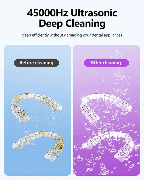 THISONG Ultrasonic Retainer Cleaner Machine 45kHz Dental Ultrasonic Retainer Cleaner for Dentures & Mouth Guard Cleaning for Whitening Trays, Toothbrush Heads, Diamond, Jewelry