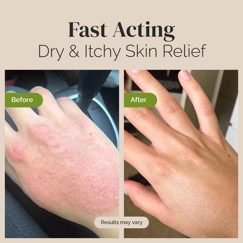 Puriya Tea Tree Oil Balm and Mother of All Creams with Mildly Earthy Scent Bundle Set, Plant Rich Wonder Balm, Moisturizing Cream for Dry, Itchy, and Sensitive Skin