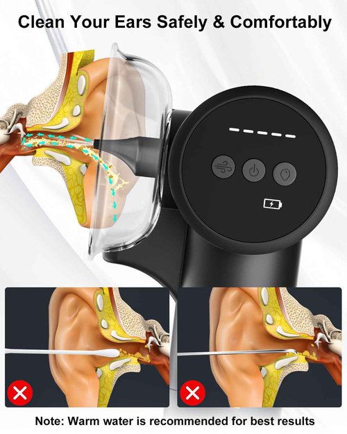Ear Wax Removal Kit- Ear Cleaner with Hot Air Drying and Waste Water Tank,5 Water Pressure Modes for Safe & Effective Ear Cleaning and Earwax Removal (Black)