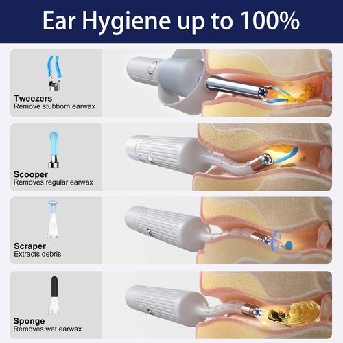 Ear Wax Removal Tool Camera, Smart WiFi Ear Cleaner with Camera, HD Visual Otoscope, Safe Silicone Flexible Scoops & Tweezers Sets Tools for Adults & Kids