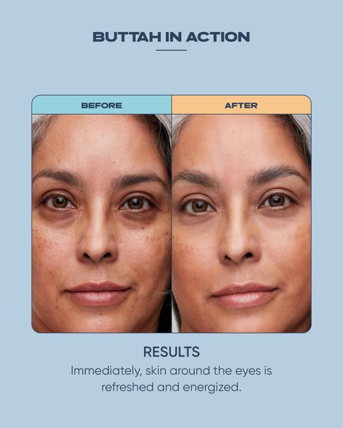 Buttah Skin Awakening Eye Cream for Dark Circles and Puffiness - Anti Aging Eye Care Cream - Eye Cream For Wrinkles - Nourishing and Hydrating Under Eye Treatment with Natural Ingredients
