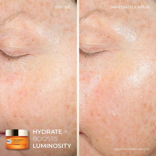 RoC Multi Correxion Revive + Glow Skin Care Regimen Bundle: Vitamin C Serum for Face + Vitamin C Cream for Tighter, Brighter Skin