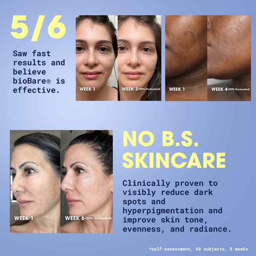 Vitamin B, CE & Ferulic Serum | 20% Pure Vitamin C Facial Serum with Hyaluronic Acid, Niacinamide & Ferulic Acid | L-Ascorbic Acid Serum for Dark Spots, Fine Lines, Wrinkles, Uneven Skin Tone