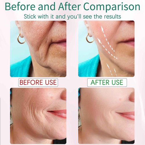 XMXW 7 Color True Beauty Glow Facial Massager, Red-Light-Therapy Wand for Facial Skin Care, Vibrating Massager for Face and Neck, Galvanic Facial Machine, Lymphatic Drainage Massager Face