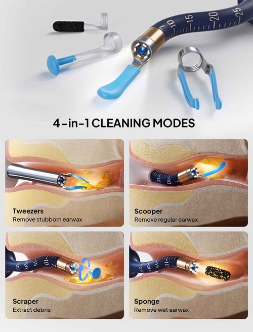 Ear Wax Removal Tool Camera, Visible Ear Cleaner Earwax Remover Kit with Tweezers, Flexible Ear Scope Otoscope with Light, Portable Cleaning Kit Earpick for Adults & Kids
