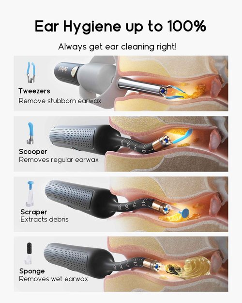 Bebird Earsight Plus R37R Ear Cleaning Camera Wax Removal Tool kit, Flexible Ear Scope Otoscope Camera Light, Visual Ear Picker Wireless Earwax Remover Tweezers for Adults & Kids