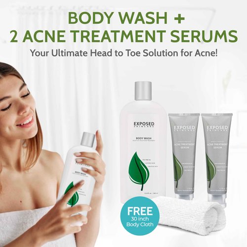Exposed Skin Care, Body Acne Kit with 3.5% Benzoyl Peroxide and 0.5% Salicylic Acid to Clear Up Teen and Adult Bacne and Body Acne – Natural, Non-toxic and Cruelty Free