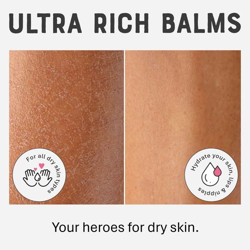 Dr. Lipp BFF ultra rich Balm 75ml & Original Nipple Balm 6x8ml BUNDLE – 14-in-TWO Multi-Use Balms for Dry Skin, Lips, Nipples & More – 100% Natural Coconut Oil & Lanolin – Fragrance & Cruelty Free
