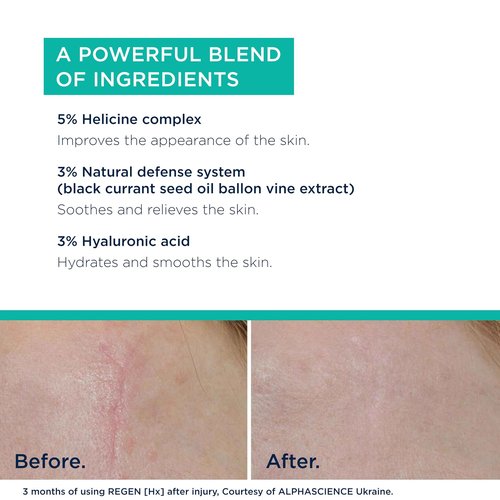 ALPHASCIENCE REGEN [HX] Cream - Helps Improve Appearance of Skin & Scars - Moisturizing - Normal & Sensitive Skin - Preservative, Fragrance & Alcohol-Free - 30 ml / 1 fl. oz.