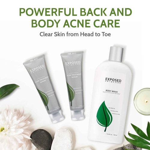 Exposed Skin Care, Body Acne Kit with 3.5% Benzoyl Peroxide and 0.5% Salicylic Acid to Clear Up Teen and Adult Bacne and Body Acne – Natural, Non-toxic and Cruelty Free