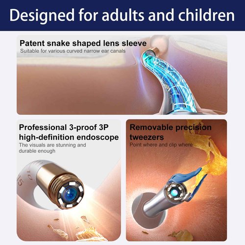 Ear Wax Removal Tool Camera, Smart WiFi Ear Cleaner with Camera, HD Visual Otoscope, Safe Silicone Flexible Scoops & Tweezers Sets Tools for Adults & Kids