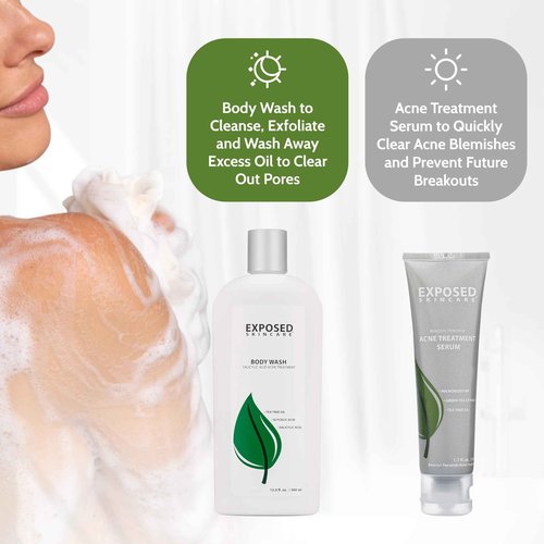 Exposed Skin Care, Body Acne Kit with 3.5% Benzoyl Peroxide and 0.5% Salicylic Acid to Clear Up Teen and Adult Bacne and Body Acne – Natural, Non-toxic and Cruelty Free