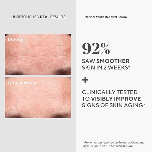 Murad Youth Renewal Retinol Trial Kit – 3-Piece Trial-Size Kit $102 Value - Anti-Aging Retinol Skincare Set - Serum for Face, Eye Serum, & Night Cream
