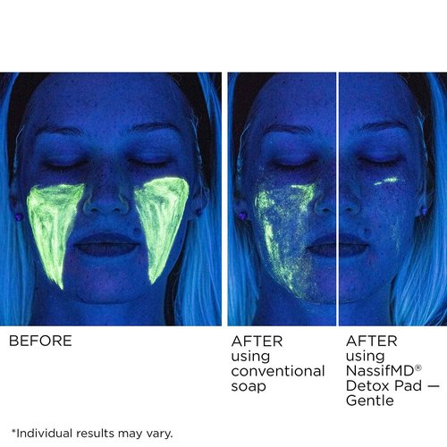 Gentle Detox Pads by NassifMD | Surgeon-Created Fruit Acid Complex for Sensitive Skin—Brightens, Exfoliates & Reduces Wrinkles, Dermatologist-Tested