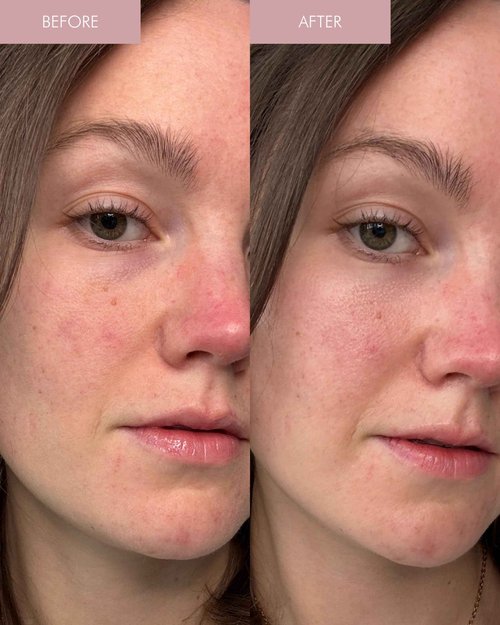 MARA - Pearl Peptide Glaze 3-in-1 Essence Toner Serum for Hydration & Redness | Prep Step to Plump + Hydrate Skin, For All Skin Types (3.38 fl oz | 100 ml)