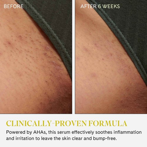 Fur Ingrown Eliminator Serum Rollerball - Powerful Ingrown Hair Treatment Serum With AHAs and BHAs to Treat and Prevent Ingrown Hairs and Bumps, Hydrates and Soothes Irritated Skin - 50 ml