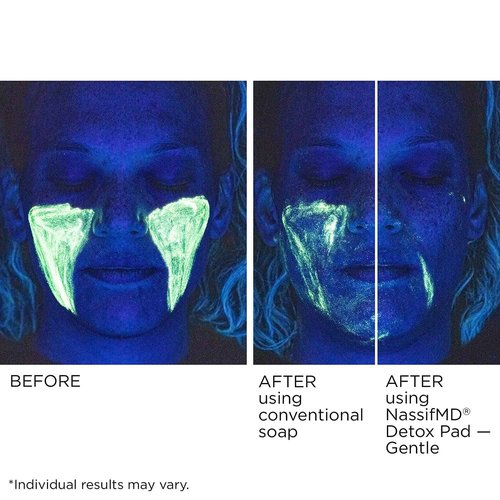 Gentle Detox Pads by NassifMD | Surgeon-Created Fruit Acid Complex for Sensitive Skin—Brightens, Exfoliates & Reduces Wrinkles, Dermatologist-Tested