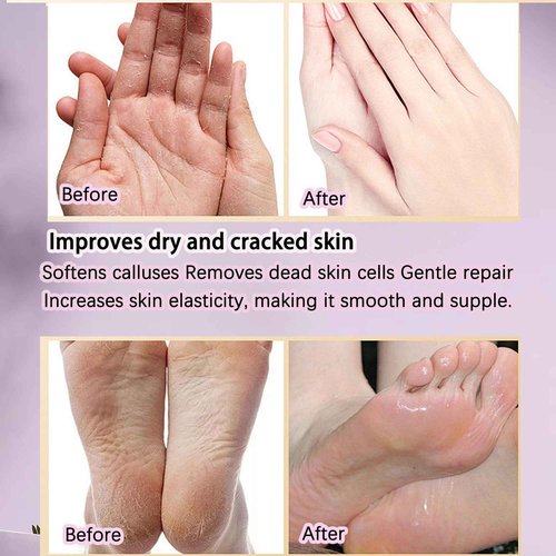 BACTIBLAST Paraffin Wax Gloves,Paraffin Hand & Foot Treatments and Booties Set for Intensive Hydration at Home Or Spa(Lavender) 2 Pair Hand & Foot Wax Gloves