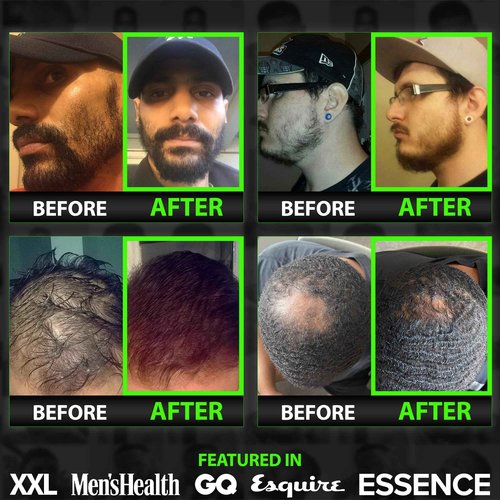 Beard Growth Kit w/ 2X Thickening Biotin Beard Balm for Men & Mustache Wax + GROW 11-in-1 Mens Shampoo & Conditioner (Hair Growth Shampoo for Men w/Biotin) - Formulated in America